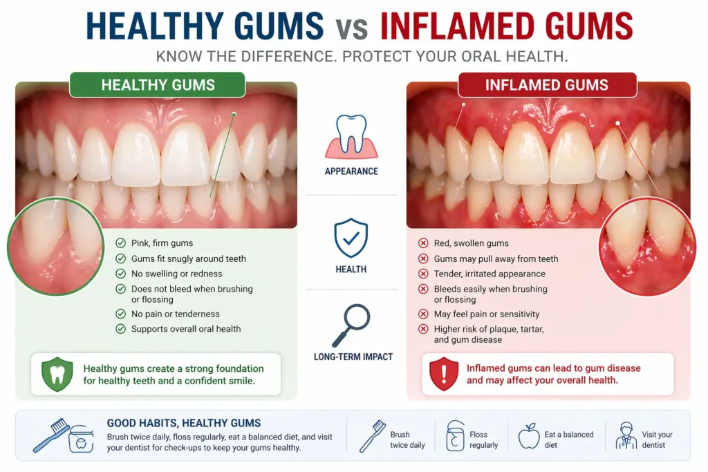 healthy gums vs inflamed gums comparison