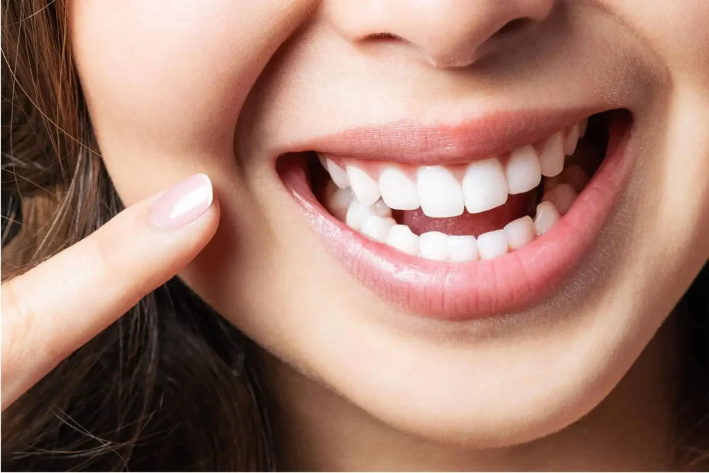healthy gums and teeth natural smile