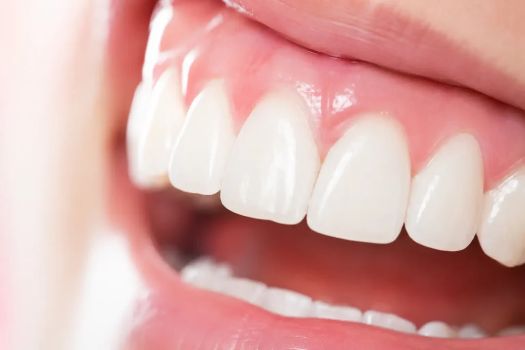 Close-up of healthy pink gums and clean teeth in a dental wellness editorial style