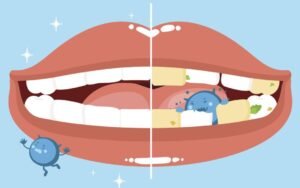 oral bacteria balance vs imbalance comparison